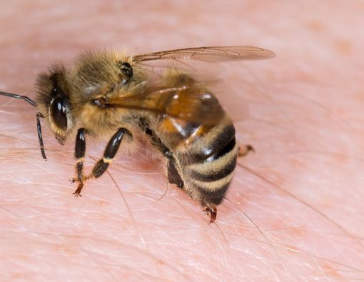 Jangan Sembarangan Terapi Sengatan Lebah, Ada Bahayanya