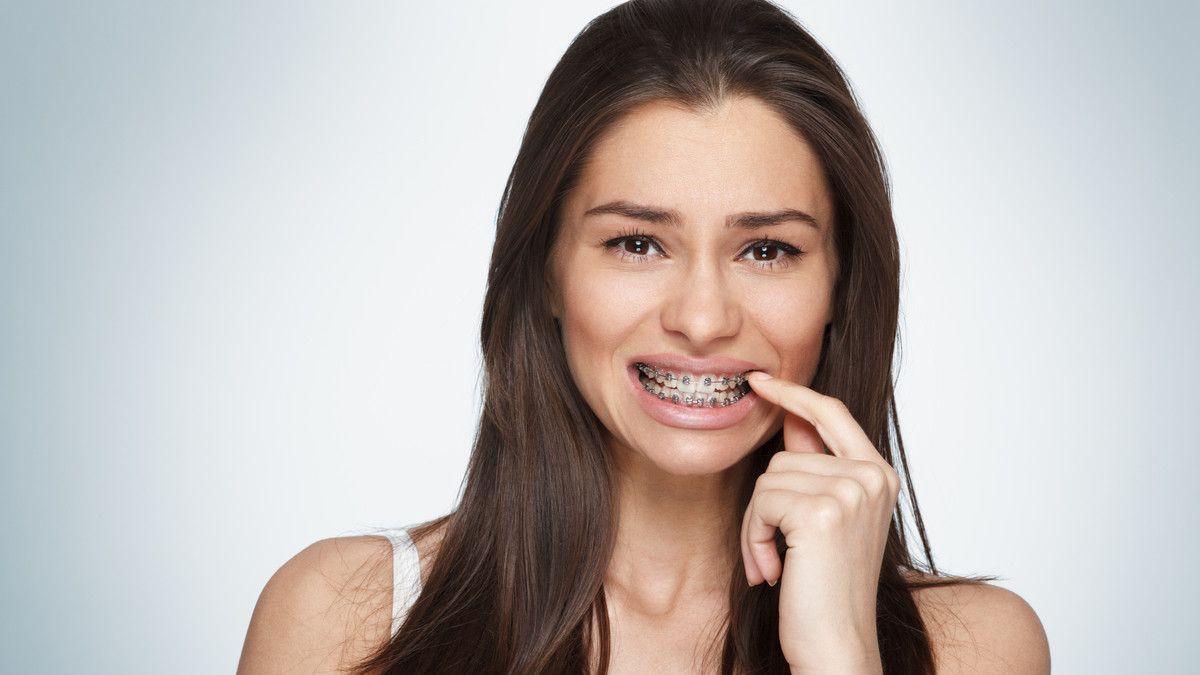 Cara Tepat Atasi Kawat Gigi Longgar