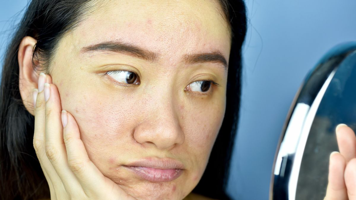 Cara Kerja Asam Salisilat