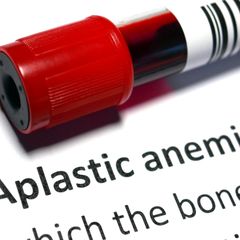 Mengapa Obat Sakit Kepala Picu Anemia Aplastik?