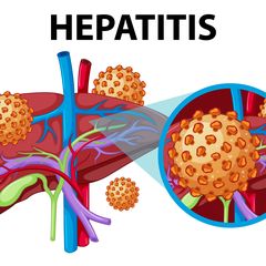 Mitos dan Fakta Seputar Hepatitis A dan B yang Masih Sering Salah Kaprah