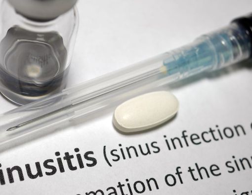 7 Jenis Obat untuk Mengatasi Sinusitis