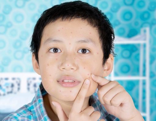 Ini Tahapan Pubertas Anak Laki-Laki yang Perlu Diketahui