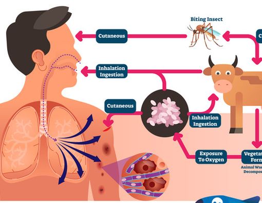 Awas, Antraks Menyerang Sistem Pernapasan!