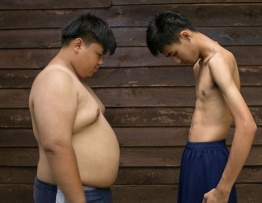 Punya Tubuh Kurus Sama Bahayanya dengan Obesitas?