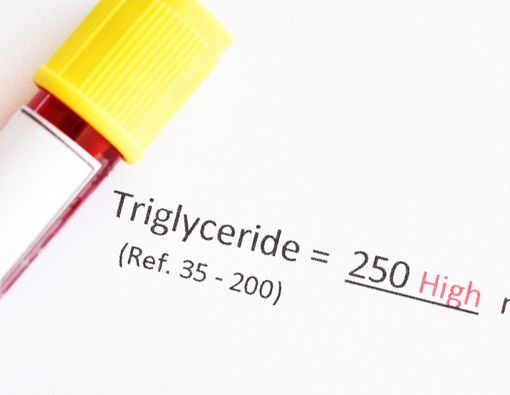 10 Cara Menurunkan Kadar Trigliserida Secara Alami