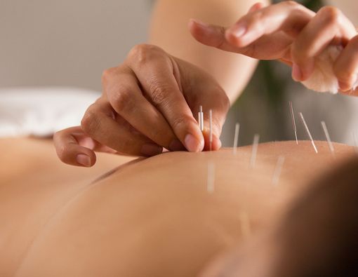 Menyingkap Bahaya Terapi Akupunktur bagi Kesehatan