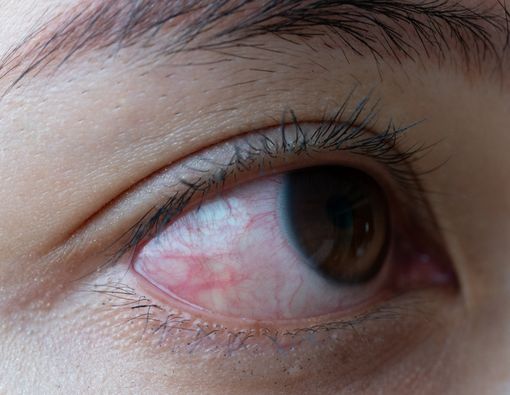 Ablasi Retina, Bisakah Disembuhkan?