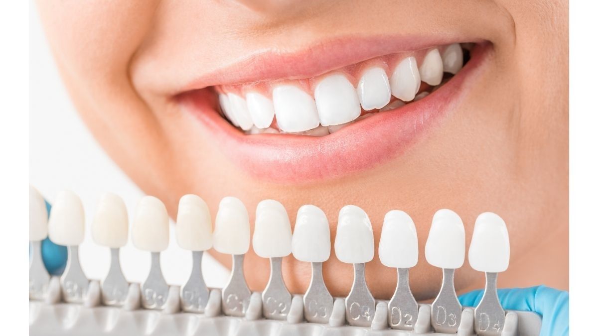 Punya Masalah Gigi Sensitif, Bolehkah Memutihkan Gigi?