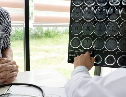 Apakah Anda Termasuk yang Berisiko Mengalami Kerusakan Sel Saraf?