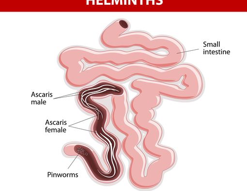 Apa Itu Cacing Kremi (Enterobiasis /Oksiuriasis)