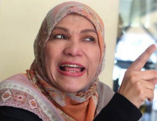 Dorce Gamalama Kena Batu Ginjal, Lama Absen dari Dunia Hiburan