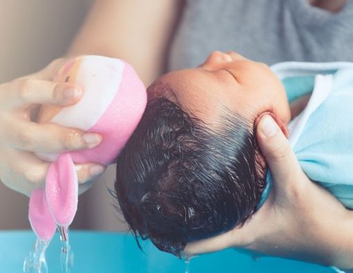 Penyebab Rambut Bayi Mengalami Kerontokan