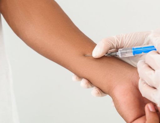 Tes Mantoux: Tujuan, Proses, dan Cara Membaca Hasil