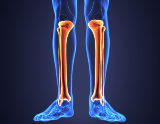 Ini Perbedaan Osteoartritis dengan Osteoporosis