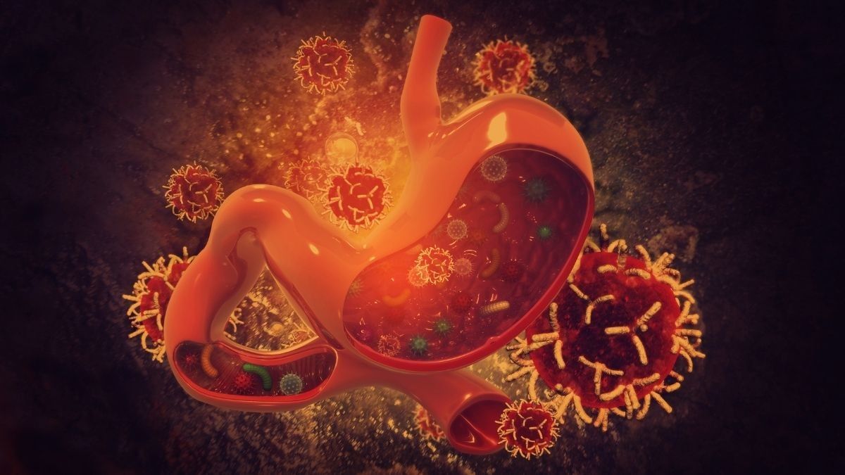 Pemanfaatan Robot pada Operasi Kanker Lambung dan Kolorektal