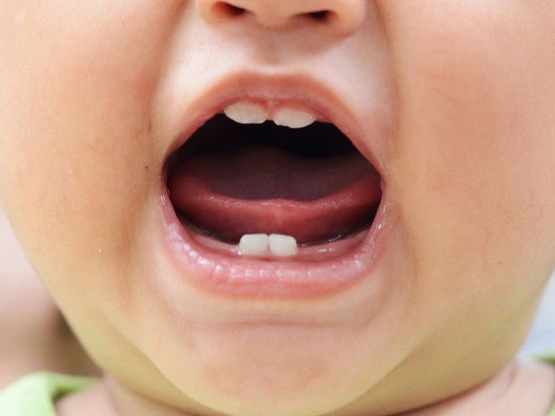 Cara Menstimulasi Pertumbuhan Gigi Si Kecil