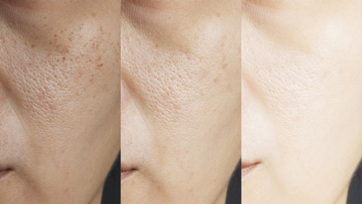 glutathione adalah Skin Whitening Brightening Anti-Aging Beauty Supplement Glutathione Tablets  - Whitening Tablets, Anti-Aging Tablets main image 0