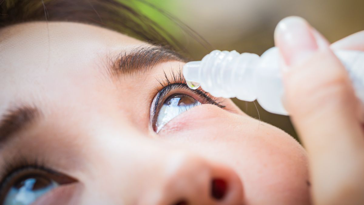 Mata Kering atau Gatal