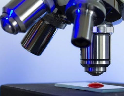 Ini Dia Perbedaan Thalassemia dengan Leukemia