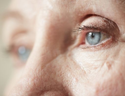 Risiko Alzheimer Bisa Dicek Lewat Kondisi Mata