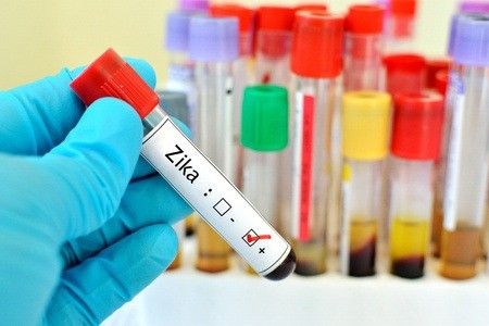 Pemeriksaan Darah untuk Mengetahui Virus Zika