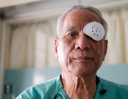 Penyebab Katarak Karena Diabetes