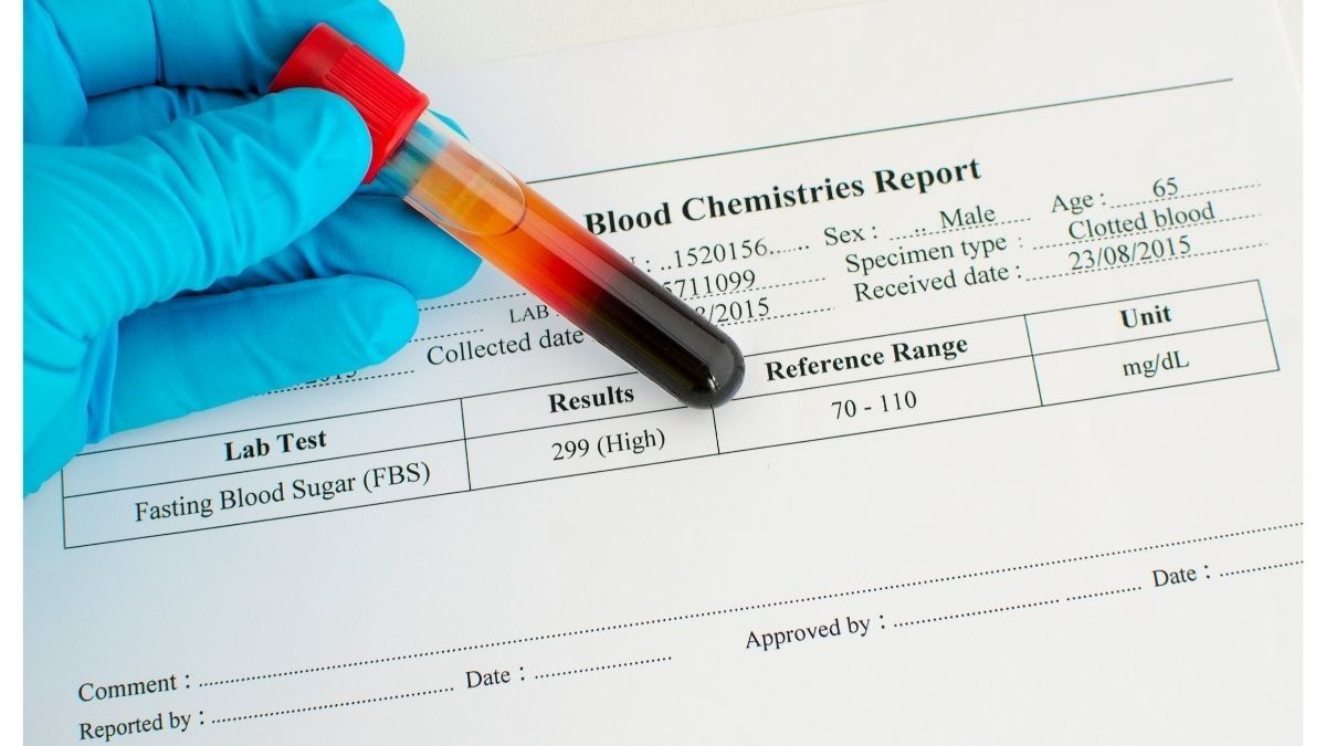 Waspada, Asupan Gula Tinggi Dapat Memicu Kanker Paru