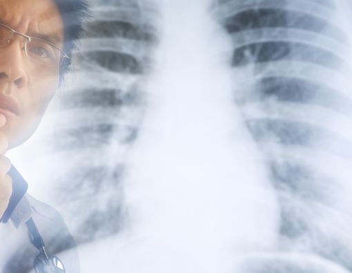 Apa Itu Pemeriksaan X-ray? Kenali Tujuan Hingga Prosedurnya