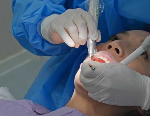 Bolehkah Sikat Gigi Setelah Melakukan Scaling?