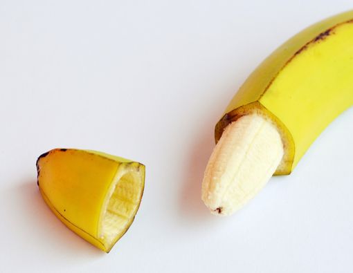 Mengenal Metode Sunat Stapler dan Kelebihannya