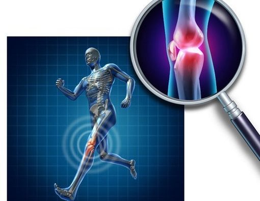 6 Mitos Tentang Osteoporosis