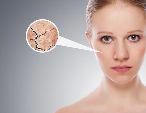 Kulit Dehidrasi dan Kulit Kering, Apa Solusinya?