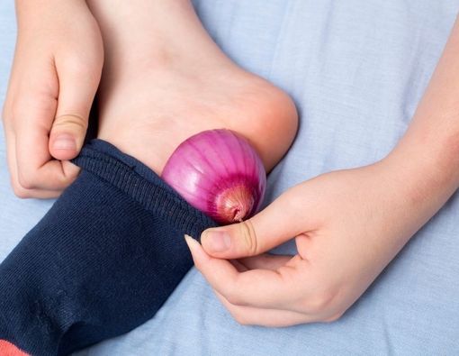 Benarkah Menaruh Bawang Bombai di Kaus Kaki Dapat Sembuhkan Flu?