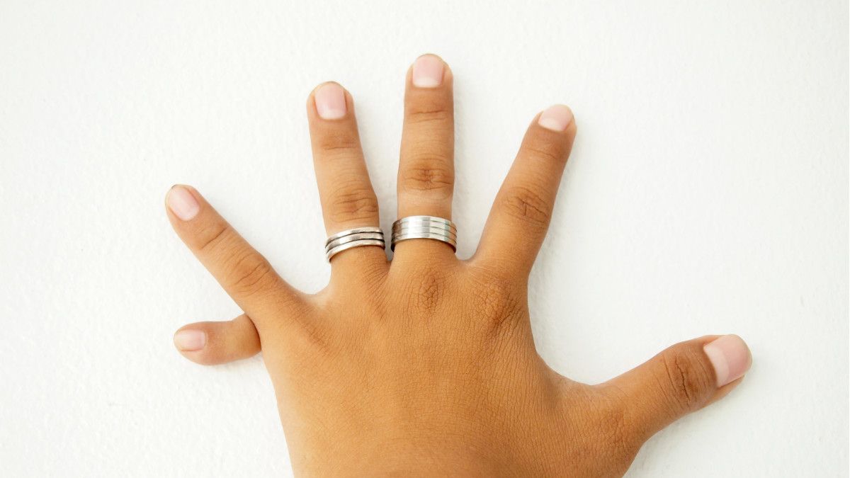 Polidaktili, Kelainan yang Membuat Seseorang Punya Jari Tambahan