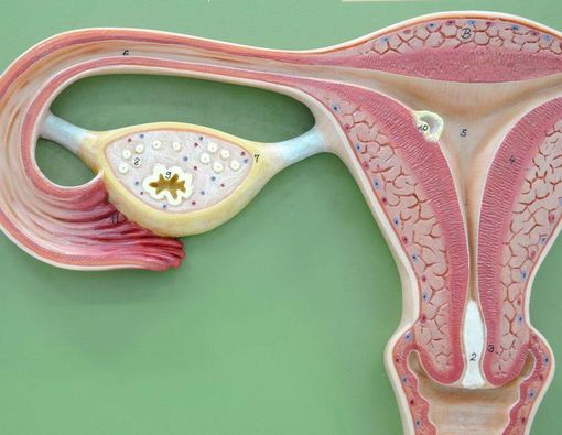 Kambuh, Kanker Serviks Jupe Kini Masuki Stadium 4