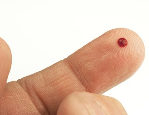 Pertolongan Stroke dengan Mengeluarkan Darah di Ujung Jari adalah Hoax