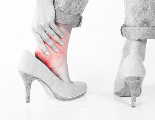 Sepatu Hak Tinggi Bisa Picu Radang Sendi