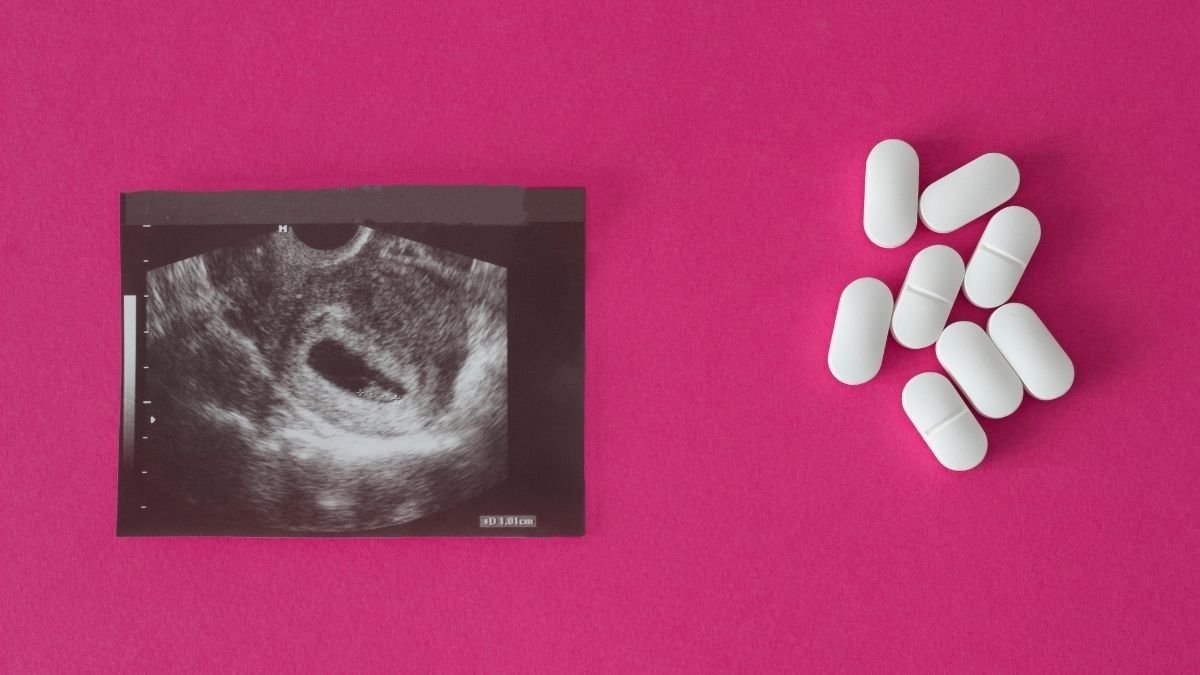 Efek Buruk Aborsi Bagi Kesehatan Mental Wanita
