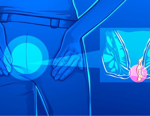 Benarkah Lansia Mudah Kena Ambeien?