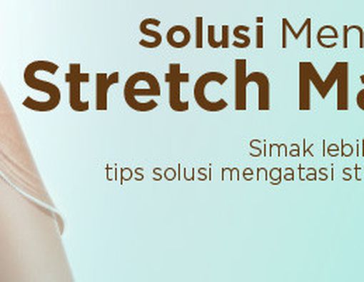 Solusi Mengatasi Stretch Marks