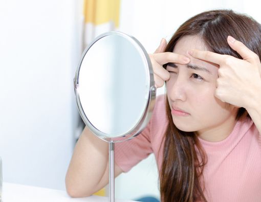 Cara Mengatasi Milia, Bentol yang Mirip Jerawat