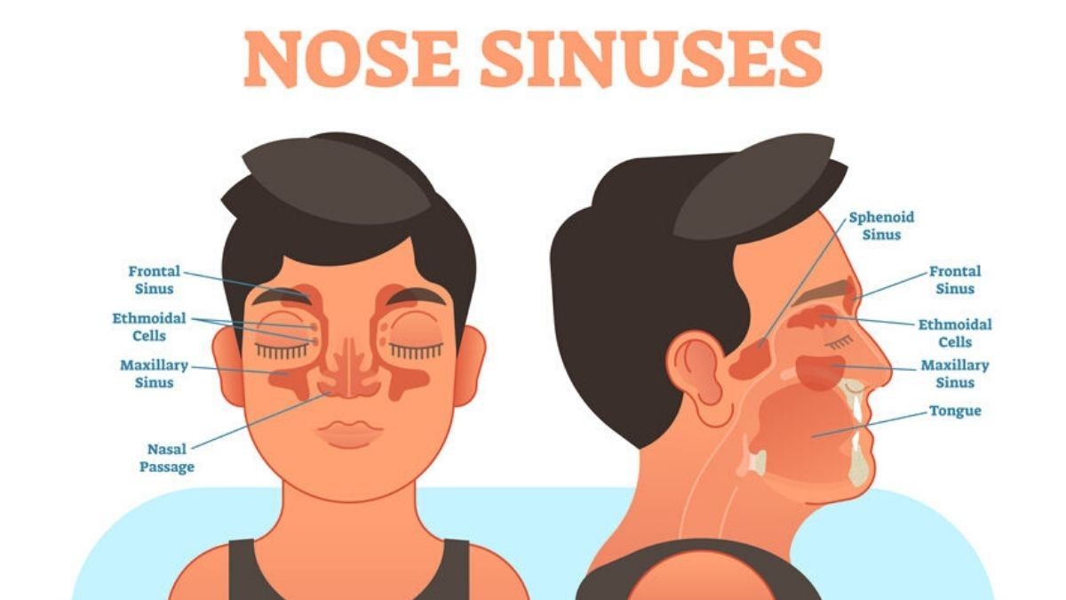 Penyebab Sakit Sinusitis seperti yang Dialami Shawn Mendes