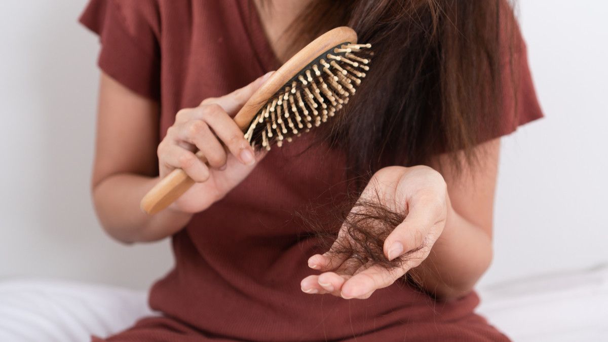 Benarkah Penyakit Lupus Sebabkan Kebotakan Rambut?