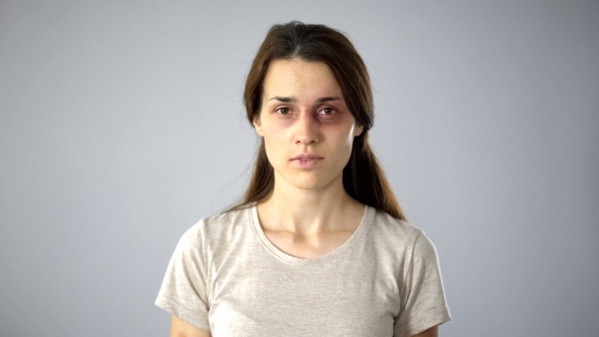 #Mugshotchallenge Bisa Ganggu Kesehatan Mental Korban Kekerasan