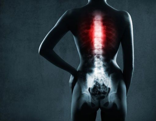 Bisa Lumpuh Akibat Cedera Tulang Belakang?