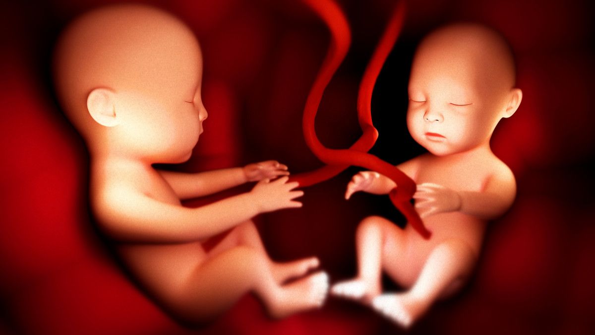 Menyingkap Tanda Kehamilan Kembar yang Jarang Disadari