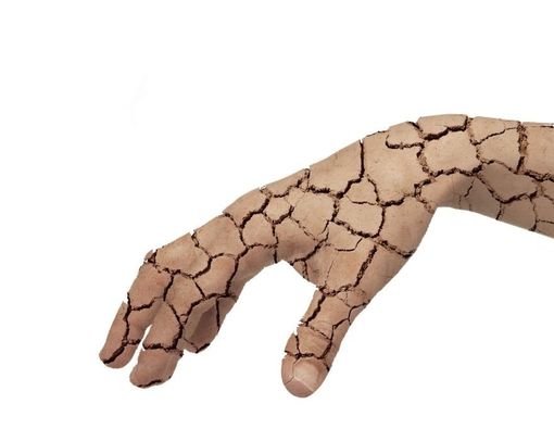 Penyebab Kulit Kering Saat Menopause dan Tips Mengatasinya