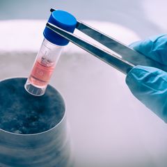 Mengenal Terapi Stem Cell dan Potensinya untuk Menyembuhkan Penyakit Berat