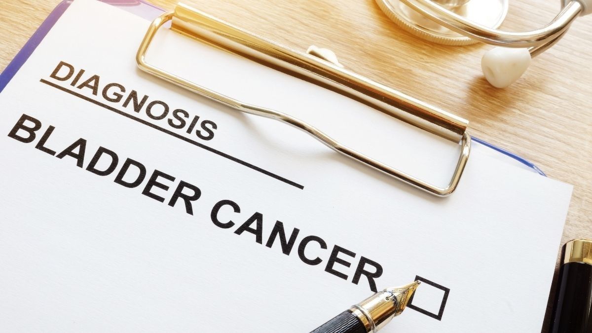 Pilihan Pengobatan untuk Mengatasi Kanker Kandung Kemih